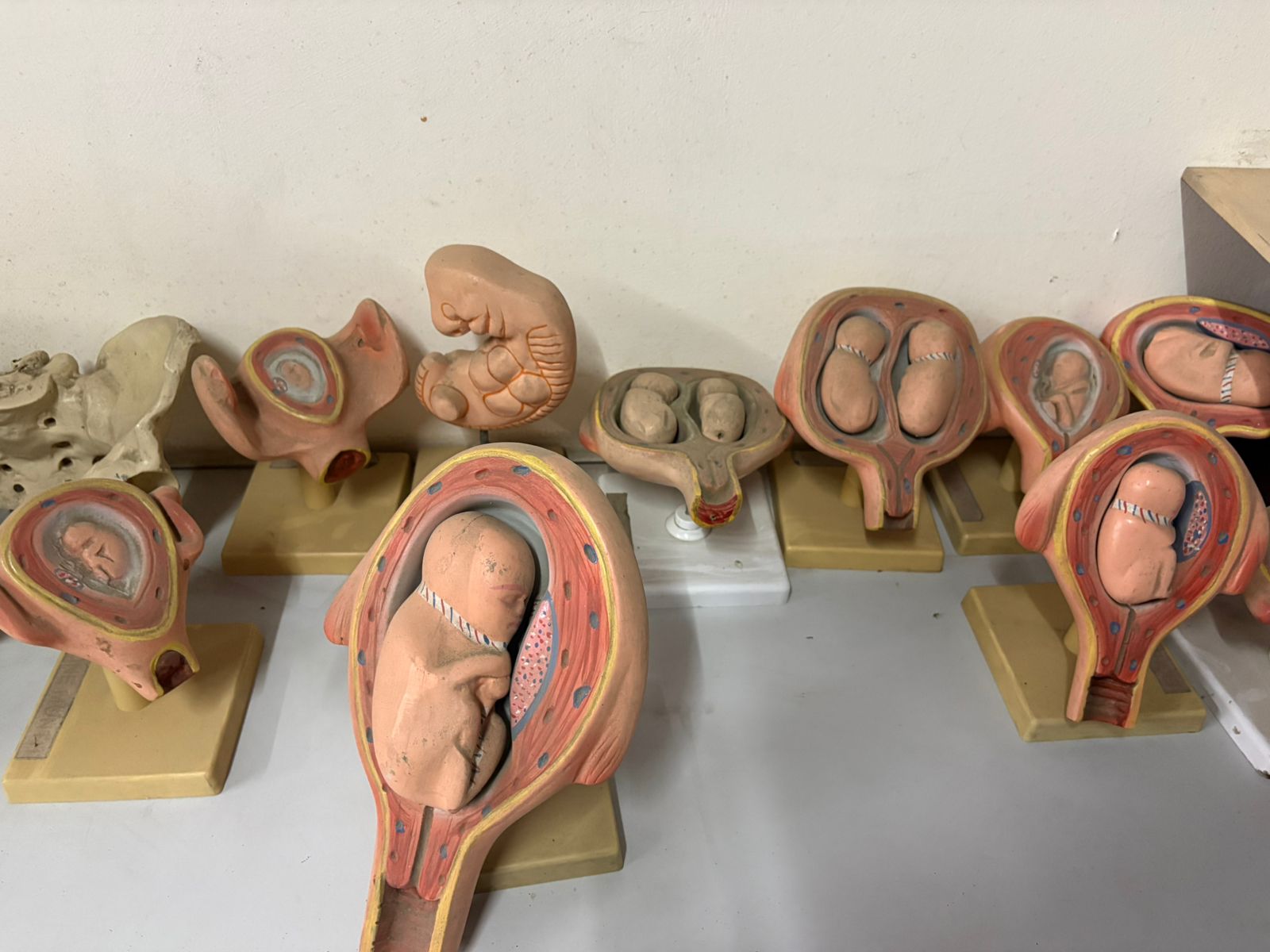 Department of Prasuti Tantra & Stree Roga - Key area 3